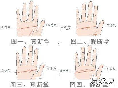 手掌有痣又有断掌说明什么?对人生有何影响?